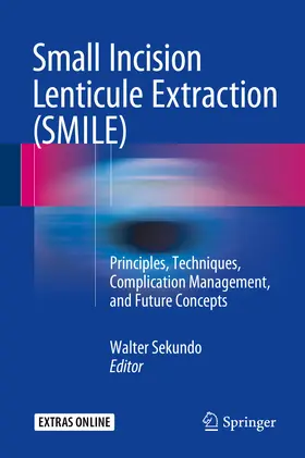 Sekundo |  Small Incision Lenticule Extraction (SMILE) | eBook | Sack Fachmedien