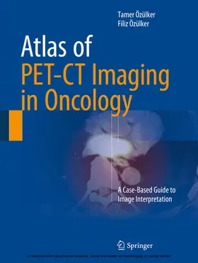 Özülker |  Atlas of PET-CT Imaging in Oncology | eBook | Sack Fachmedien