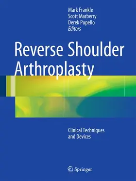 Frankle / Marberry / Pupello |  Reverse Shoulder Arthroplasty | Buch |  Sack Fachmedien