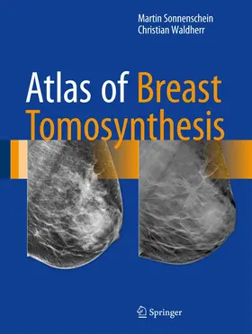 Sonnenschein / Waldherr |  Atlas of Breast Tomosynthesis | Buch |  Sack Fachmedien