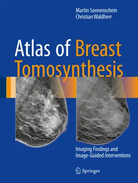 Sonnenschein / Waldherr |  Atlas of Breast Tomosynthesis | eBook | Sack Fachmedien