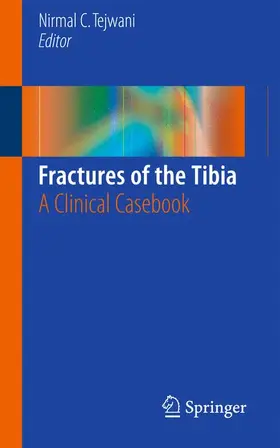 Tejwani |  Fractures of the Tibia | Buch |  Sack Fachmedien