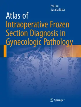 Buza / Hui | Atlas of Intraoperative Frozen Section Diagnosis in Gynecologic Pathology | Buch | 978-3-319-21806-9 | sack.de