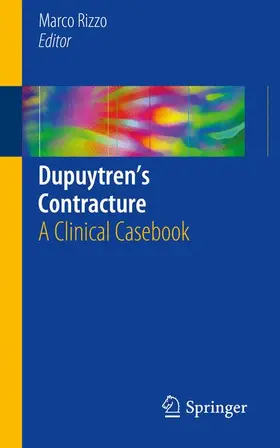 Rizzo |  Dupuytren's Contracture | Buch |  Sack Fachmedien