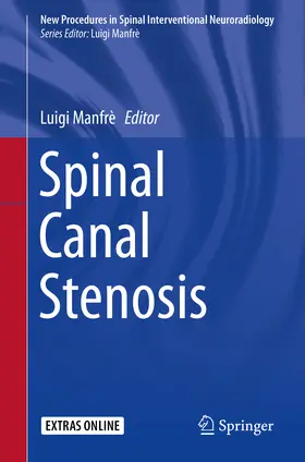 Manfrè | Spinal Canal Stenosis | E-Book | sack.de
