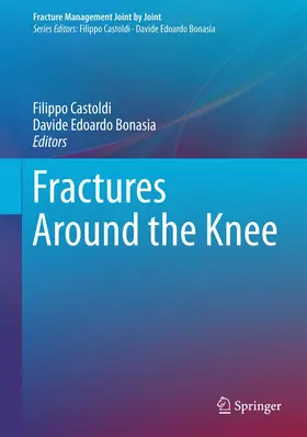 Castoldi / Bonasia |  Fractures Around the Knee | Buch |  Sack Fachmedien