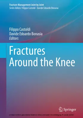 Castoldi / Bonasia |  Fractures Around the Knee | eBook | Sack Fachmedien