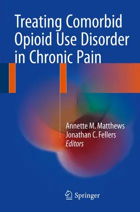 Fellers / Matthews |  Treating Comorbid Opioid Use Disorder in Chronic Pain | Buch |  Sack Fachmedien