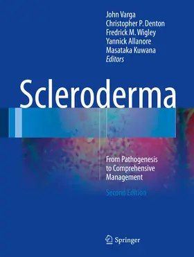 Varga / Denton / Wigley |  Scleroderma | eBook | Sack Fachmedien