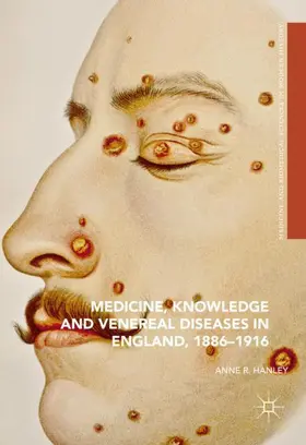 Hanley |  Medicine, Knowledge and Venereal Diseases in England, 1886-1916 | Buch |  Sack Fachmedien