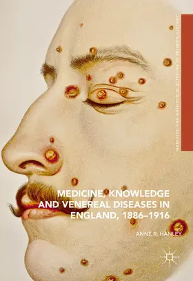 Hanley |  Medicine, Knowledge and Venereal Diseases in England, 1886-1916 | eBook | Sack Fachmedien