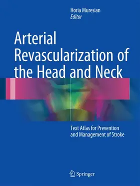 Muresian |  Arterial Revascularization of the Head and Neck | Buch |  Sack Fachmedien