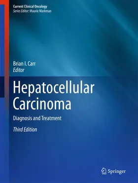 Carr |  Hepatocellular Carcinoma | Buch |  Sack Fachmedien