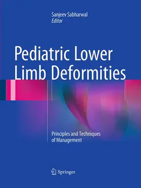 Sabharwal |  Pediatric Lower Limb Deformities | Buch |  Sack Fachmedien