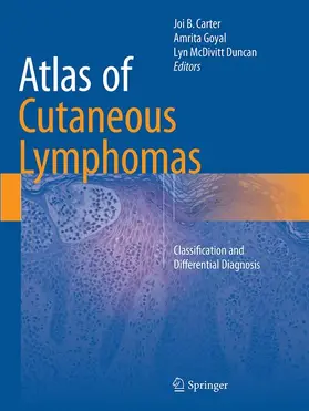 Carter / McDivitt Duncan / Goyal |  Atlas of Cutaneous Lymphomas | Buch |  Sack Fachmedien