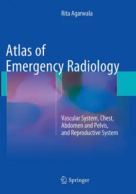 Agarwala |  Atlas of Emergency Radiology | Buch |  Sack Fachmedien