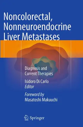 Di Carlo |  Noncolorectal, Nonneuroendocrine Liver Metastases | Buch |  Sack Fachmedien