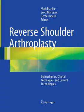Frankle / Marberry / Pupello |  Reverse Shoulder Arthroplasty | Buch |  Sack Fachmedien