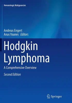 Younes / Engert |  Hodgkin Lymphoma | Buch |  Sack Fachmedien