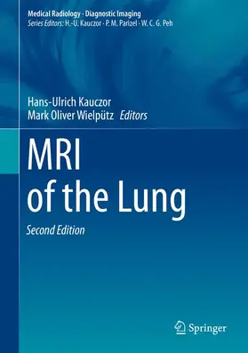 Kauczor / Wielpütz |  MRI of the Lung | Buch |  Sack Fachmedien