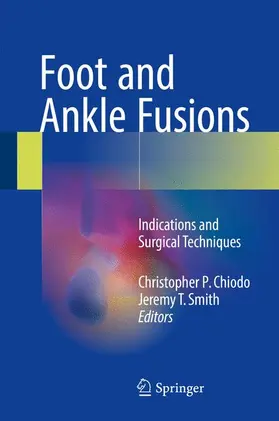 Smith / Chiodo |  Foot and Ankle Fusions | Buch |  Sack Fachmedien