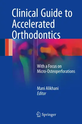 Alikhani | Clinical Guide to Accelerated Orthodontics | Buch | 978-3-319-43399-8 | sack.de