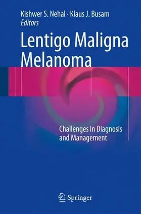 Busam / Nehal |  Lentigo Maligna Melanoma | Buch |  Sack Fachmedien