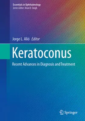 Alió |  Keratoconus | Buch |  Sack Fachmedien