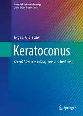 Alió | Keratoconus | E-Book | sack.de