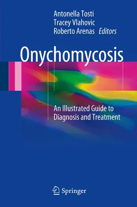 Tosti / Arenas / Vlahovic |  Onychomycosis | Buch |  Sack Fachmedien