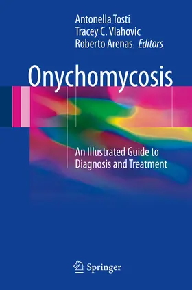 Tosti / Vlahovic / Arenas |  Onychomycosis | eBook | Sack Fachmedien