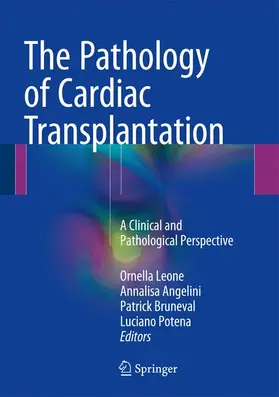 Leone / Potena / Angelini |  The Pathology of Cardiac Transplantation | Buch |  Sack Fachmedien