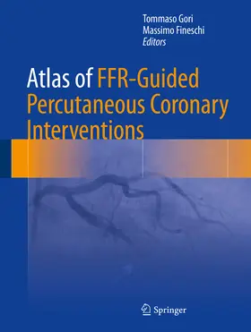 Gori / Fineschi |  Atlas of FFR-Guided Percutaneous Coronary Interventions | eBook | Sack Fachmedien