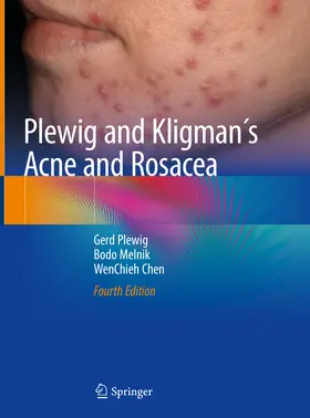 Plewig / Melnik / Chen | Plewig and Kligman´s Acne and Rosacea | E-Book | sack.de
