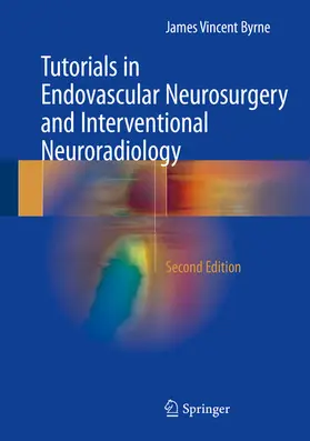 Byrne | Tutorials in Endovascular Neurosurgery and Interventional Neuroradiology | E-Book | www2.sack.de