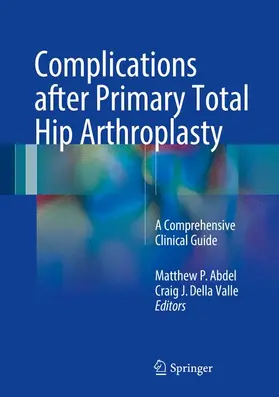 Abdel / Della Valle | Complications after Primary Total Hip Arthroplasty | Buch | 978-3-319-54911-8 | sack.de