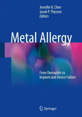 Chen / Thyssen | Metal Allergy | E-Book | sack.de