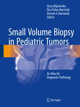 Klijanienko / Pohar Marinšek / Pohar Marinsek | Small Volume Biopsy in Pediatric Tumors | E-Book | sack.de