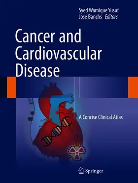 Banchs / Yusuf |  Cancer and Cardiovascular Disease | Buch |  Sack Fachmedien