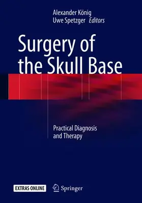 Spetzger / König |  Surgery of the Skull Base | Buch |  Sack Fachmedien