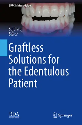 Jivraj |  Graftless Solutions for the Edentulous Patient | eBook | Sack Fachmedien