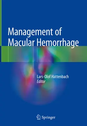 Hattenbach |  Management of Macular Hemorrhage | eBook | Sack Fachmedien