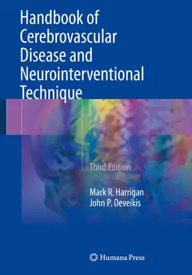 Harrigan / Deveikis |  Handbook of Cerebrovascular Disease and Neurointerventional Technique | eBook | Sack Fachmedien