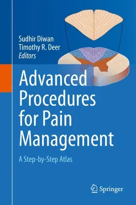 Deer / Diwan |  Advanced Procedures for Pain Management | Buch |  Sack Fachmedien