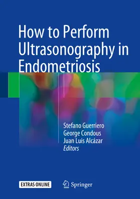 Guerriero / Condous / Alcázar |  How to Perform Ultrasonography in Endometriosis | eBook | Sack Fachmedien