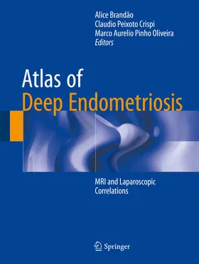 Brandão / Crispi / Oliveira |  Atlas of Deep Endometriosis | eBook | Sack Fachmedien