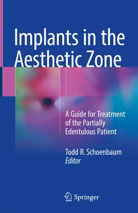 Schoenbaum |  Implants in the Aesthetic Zone | eBook | Sack Fachmedien