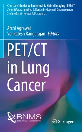 Agrawal / Rangarajan | PET/CT in Lung Cancer | E-Book | sack.de