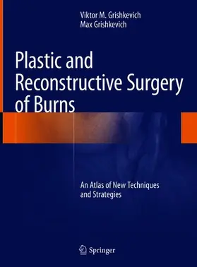 Grishkevich |  Plastic and Reconstructive Surgery of Burns | Buch |  Sack Fachmedien