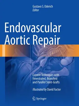 Oderich |  Endovascular Aortic Repair | Buch |  Sack Fachmedien